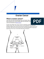Cancer Ovarian
