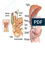 COLECISTITIS Y COLELITIASIS.docx