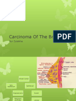 Carcinoma of The Breast: Nur Zulaikha