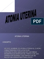 Atonia Uterina