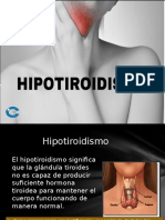 HIPOTIROIDISMO