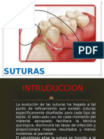 SUTURAS EN ODONTOLOGIA 