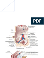 Tambahan Hernia