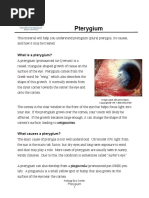 Pterygium