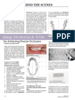 Using Shimstock Film For Achieving Precise Occlusion