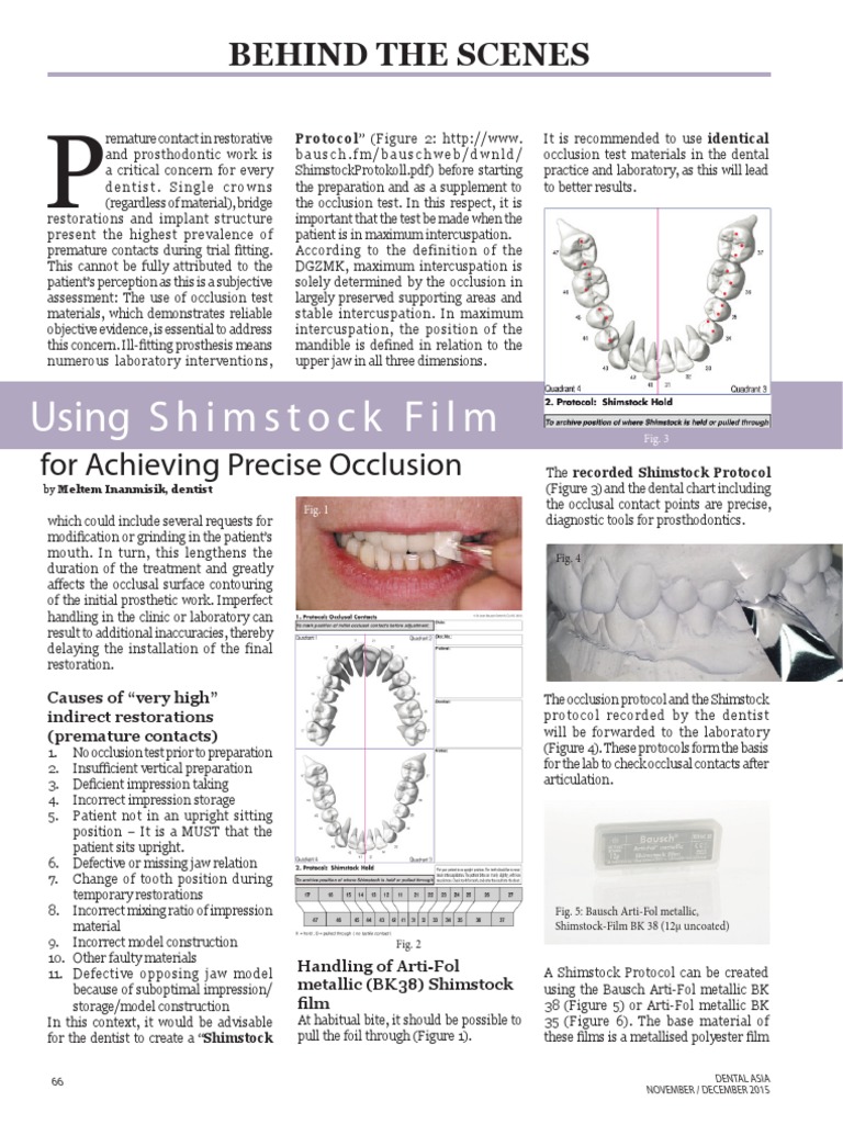 Using Shimstock Film For Achieving Precise Occlusion PDF Prosthesis