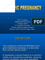 Ectopic Pregnancy3