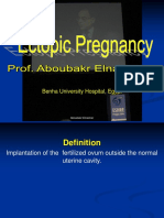 Ectopic Pregnancy4