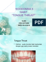 Tongue Thrust by Yon Aditama