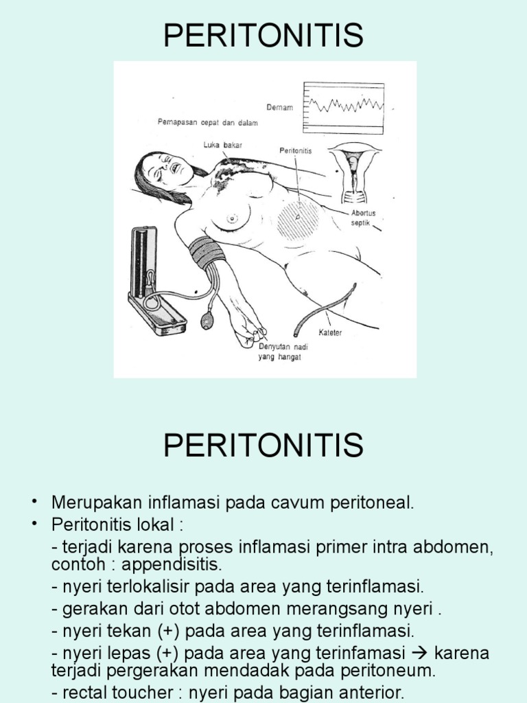 Peritonitis | PDF