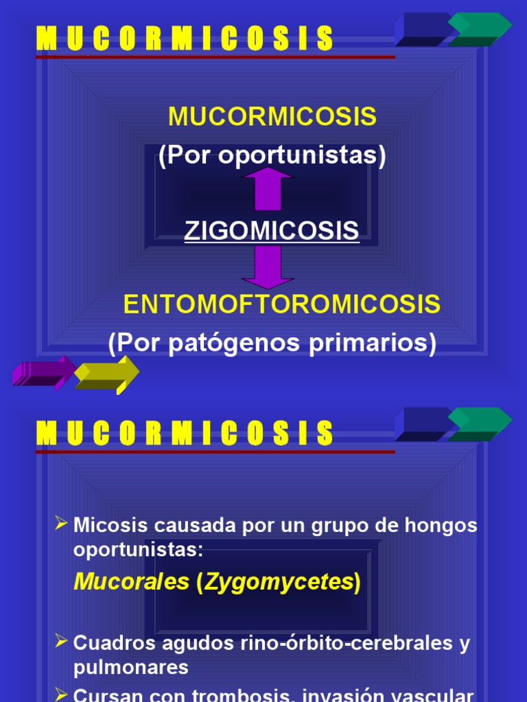 Mucormicosis Textos Diabetes Mellitus Especialidades Medicas