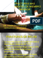 FRACTURAS MAS FRECUENTES DE MIEMBRO INFERIOR.ppt