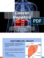 Tumores hepáticos primarios: Hepatocarcinoma