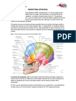 HEMATOMA EPIDURAL Y HEMATOMA SUBDURAL.pdf