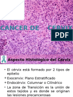 Cáncer cérvix histología VPH