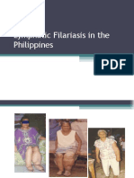 Lymphatic Filariasis in The Philippines