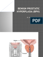 Bedah Benign Prostatic Hyperplasia