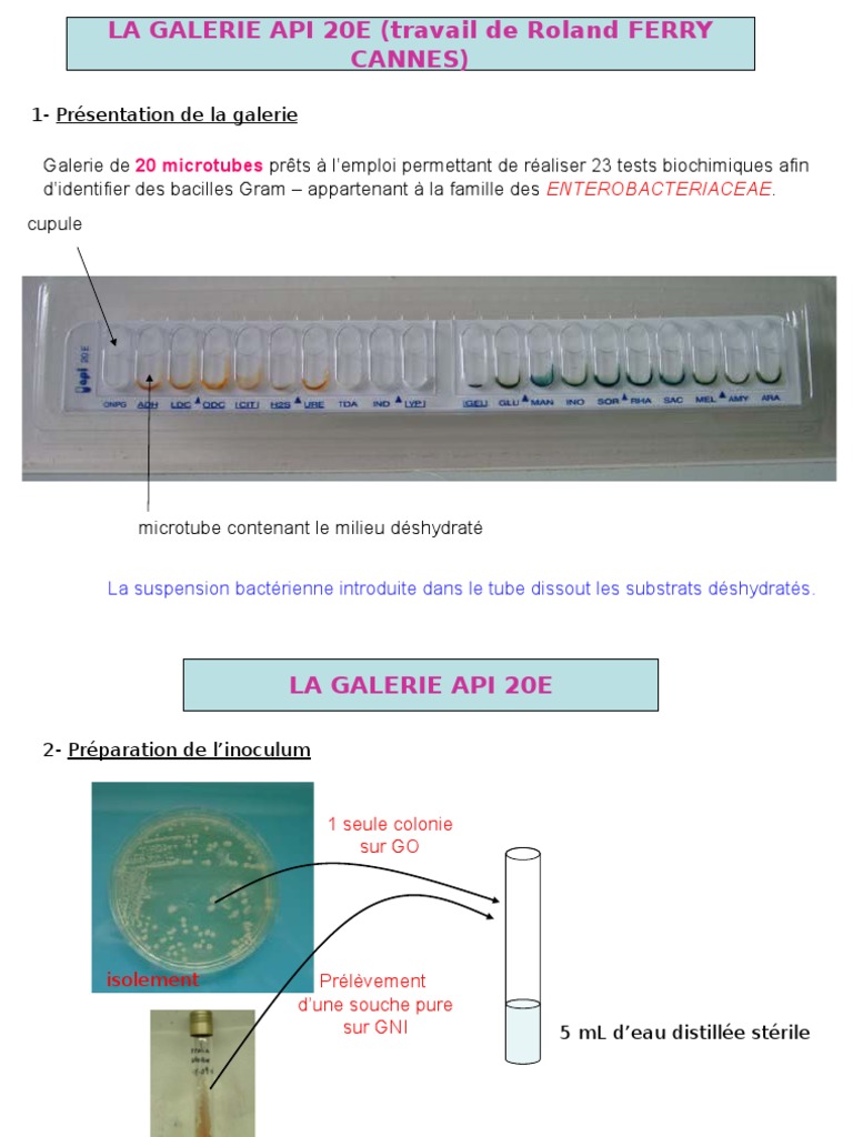 Identification bactérienne avec API 20E | PDF | Microbiologie | Prokaryota
