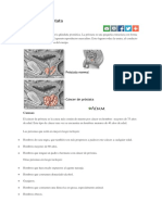 Cáncer de Próstata PDF