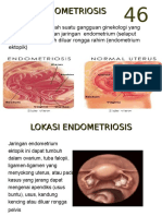 Kuliah Endometriosis II 03