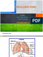 Referat Pulmonologi TB Paru