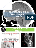 DISERTACIÓN NEURO TAC.pptx