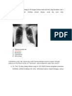 Tugas Radiologi