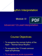 ECG Rhythm Interpretation