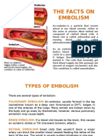 Embolism