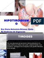 Hipotiroidismo