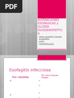 ALTERACIONES ESOFAGICAS