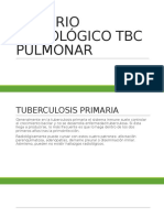 Criterio Radiológico TBC Pulmonar