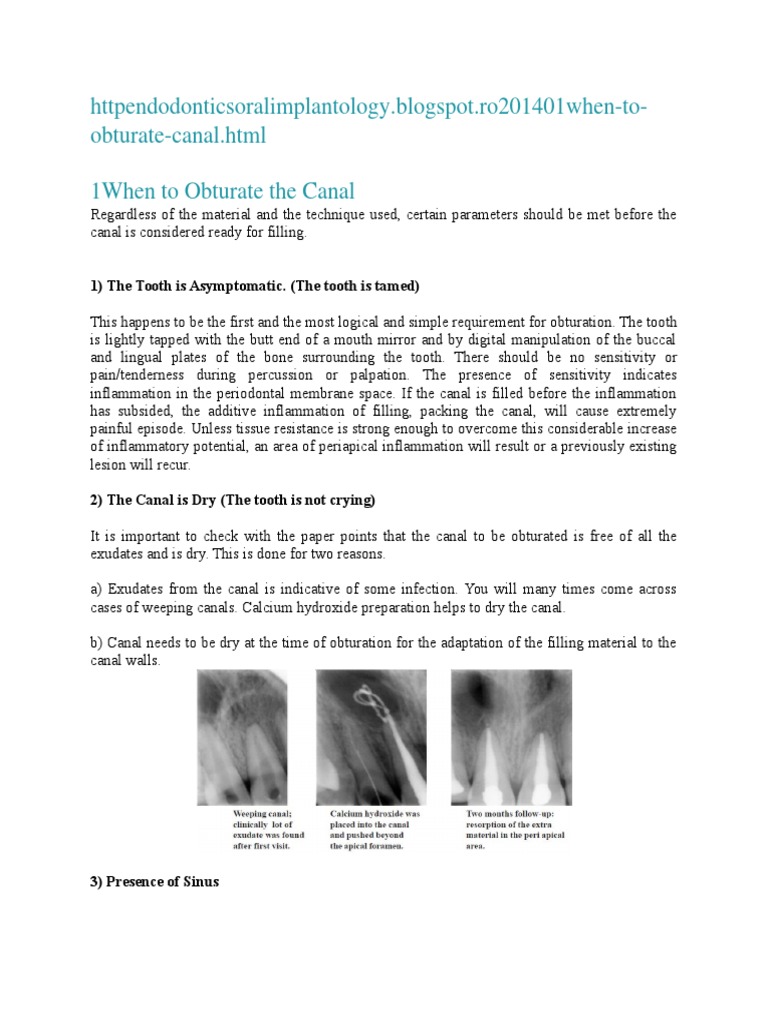 Obturate Canal HTML 1when To Obturate The Canal 1) The Tooth Is