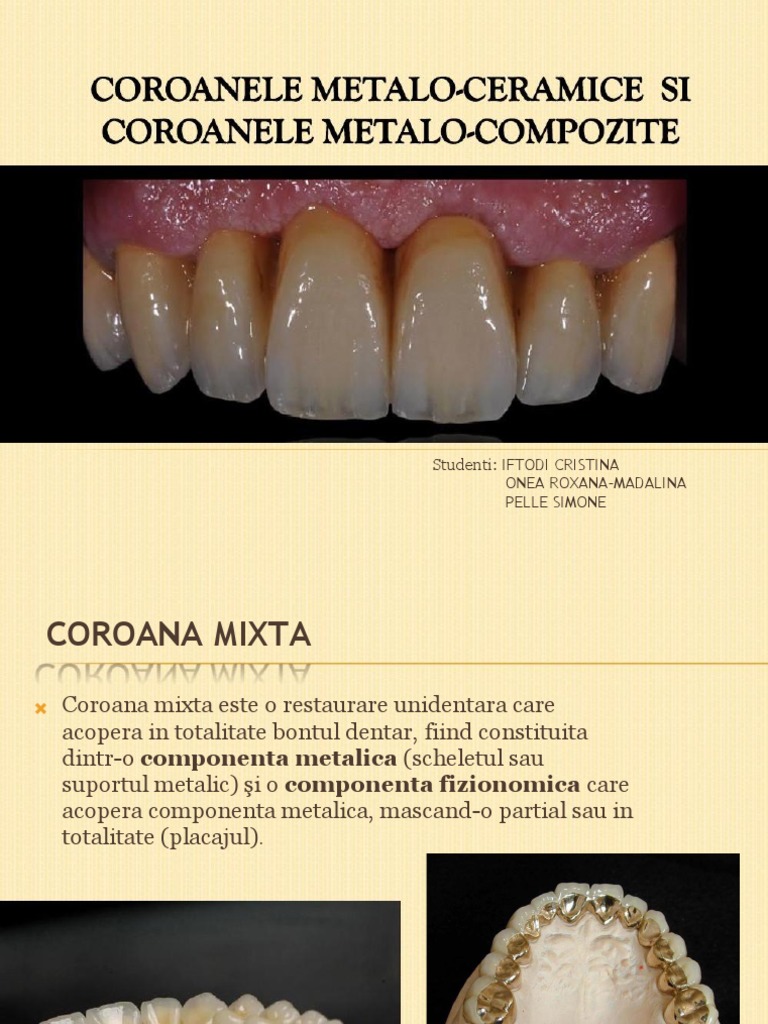 Coroana Metalo-Ceramica Si Coroana Metalo-Compozit | PDF