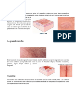 Lesiones