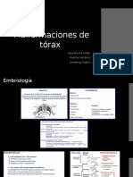 Malformaciones de tórax