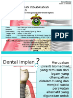 Journal Reading Parameter Pada Penempatan Dan Penanganan Implan Dental