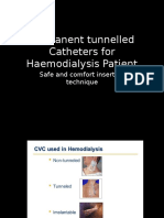 Permanent Tunnel Catheter 