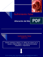 Sufrimiento Fetal