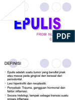 EPULIS.ppt