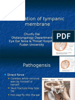 Perforation of Tympanic Membrane