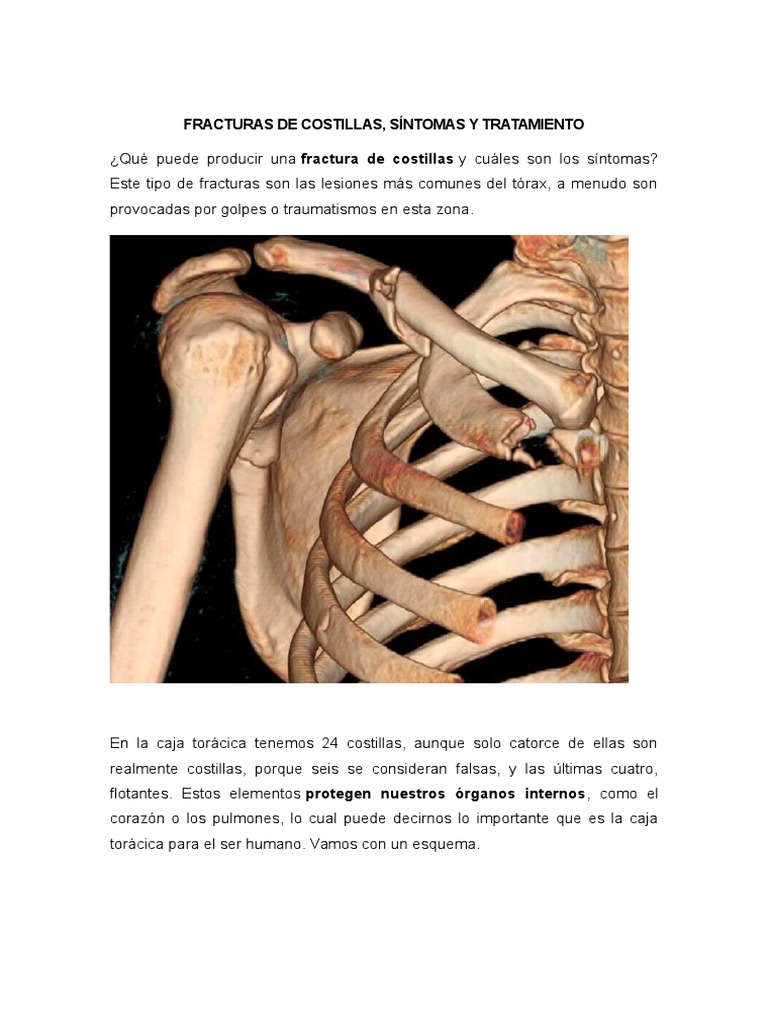 fracturas-de-costillas-pdf-t-rax-lesi-n