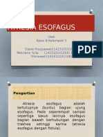 Atresia Esofagus