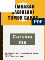 Gambaran Radiologi Tumor Ganas