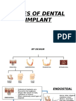 Types of Dental Implant