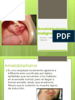 Ameloblastoma Maligno