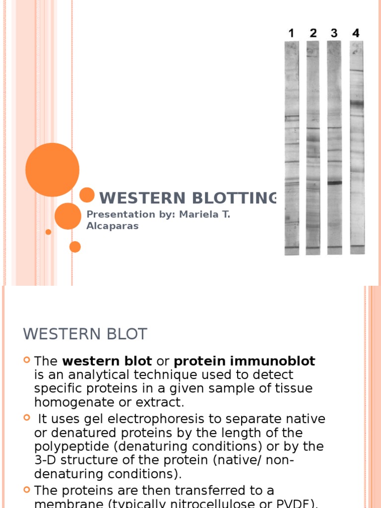 Exondys 51 label image