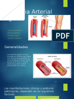 Isquemia Arterial Aguda 