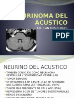 Neurinoma Del Acustico