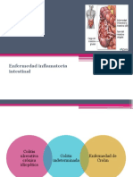 SX Crohn y Cuci